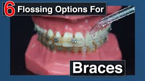 Gently rub the side of the tooth, moving the floss away from. How To Floss With Braces Youtube