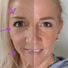 Plus 6 ways your skincare routine will change for the better!