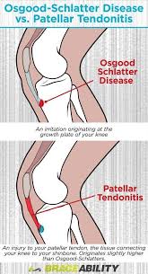 Pin On Inside Knee Pain