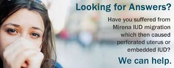 Alopecia areata is hair loss, usually reversible, in sharply defined areas, usually involving beard or scalp.1 it is listed in the mirena product information as an uncommon adverse. Pin On Mirena Iud Lawsuit