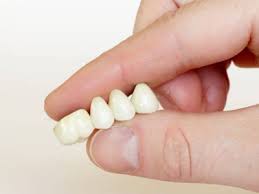 Low Cost 3m Lava Premium Dental Crowns South Delhi India