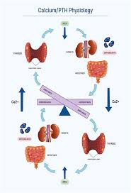 Image result for Hyperparathyroidism