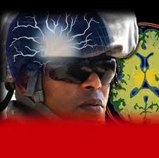 Non-Impact, Blast-Induced Mild Traumatic Brain Injury