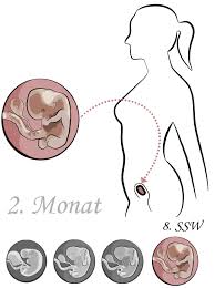 Wann fängt die übelkeit an??? 8 Ssw 8 Schwangerschaftswoche Ultraschall Fehlgeburt Bauch