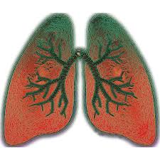Lung cancer may not produce any noticeable symptoms in the early stages, and many people aren't diagnosed until the disease has advanced. How A Social Security Lawyer For Lung Cancer Can Help Your Case Disability Help Group Arizona