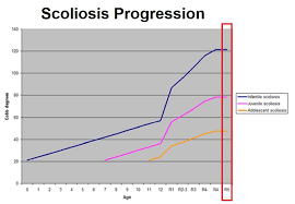 scoliosis in children hudson valley scoliosis