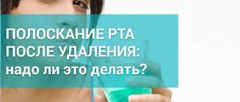 После того, как вам удалили зуб, доктор дал вам четкие инструкции и рекомендации о том, что нужно делать, а чего нельзя. Chem Poloskat Rot Posle Udaleniya Zuba Sovety Stomatologov