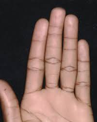 You may have noticed that often the stereotypical businessman who has a strong liking for making lots of. Finger Creases Handlab Resources