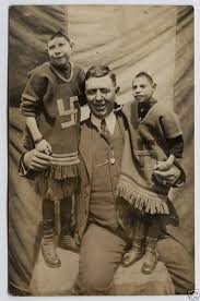 Y por aquello quedó en su cuerpo una pelvis de más. Marina Amaral On Twitter Josephine Myrtle Corbin Had Two Separate Pelvises Side By Side From The Waist Down As A Result Of Her Body Axis Splitting As It Developed Https T Co 1qu1m9fwrv