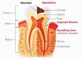 Pin On Tooth