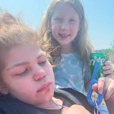 What is life like for a family dealing with Sanfilippo Syndrome? How is it  different and how is it the same? “We have nursing, so we have someone  other than family in