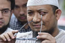 .(kpk) novel baswedan mendengar informasi perihal puluhan pegawai kpk termasuk dirinya tidak lolos tes wawasan kebangasaan sebagai bagian dari proses alih status menjadi aparatur sipil negara. I Still Get Threats After Acid Attack Novel Baswedan National The Jakarta Post