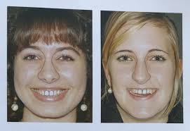 Подбор формы и цвета искусственных зубов: история, методы и современные  подходы