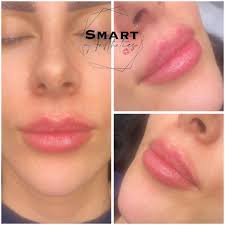 SMART Aesthetics, Bristol