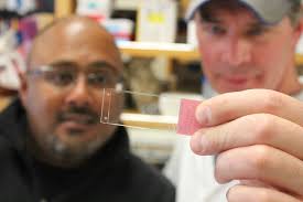 Concussion: Answers in the Blood?