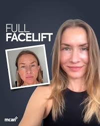 Marina's Rasional Holday: Sayıyorsun hasta 火 olcan MCAN için yapılan  mmaproveamin Mısırulu eğitncu danıştlinysan