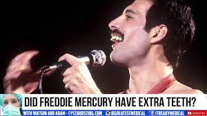 However, freddy was never ready to get his teeth fixed. Did Freddie Mercury Have Extra Teeth Youtube