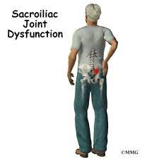 Treatments for sacroiliac joint dysfunction (si joint pain) typically focus on alleviating pain and restoring normal motion in the joint. Patient Education Concord Orthopaedics