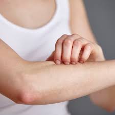 Using Hydrocortisone Cream For Skin Rashes