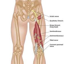 De musculus biceps femoris, de musculus semitendinosus en de musculus semimembranosus. Proximal Hamstring Tendinopathy Highhamstring Twitter