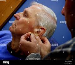 Air force acupuncture hi-res stock photography and images