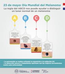 La causa más común del melanoma es la exposición a radiación ultravioleta (uv) proveniente de los. Permanecer Alerta Ante El Melanoma Ministerio De Salud Publica Y Bienestar Social