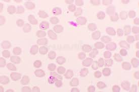 Distinguish between species on thick and thin films. Plasmodium Falciparum Photos Free Royalty Free Stock Photos From Dreamstime