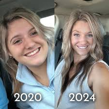 No, my face wasn't swollen it was bloated & fat😅 And one of my biggest  insecurities besides my stomach at the time One of the hardest things for  me was going from