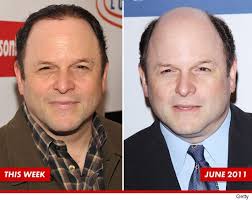 It requires a lot of time to nourish the hair and still the hair growth process is quite slow. Balding And What Jason Alexander Is Doing About His Hair Loss Celebrity Diagnosis