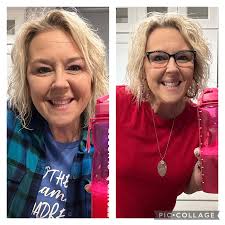 What to expect after the second shot of Ozempic 0.25?