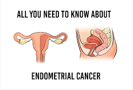 A swollen prostate can make it hard to go, or it may make you have to go a lot. Endometrial Cancer Symptoms Causes And Prevention Getdoc Says