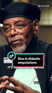 Jay Bradley Starks, a diabetic amputee, speaks to @Steve Osunsami about how  unconscious bias nearly cost him when he went to the emergency room with  frostbite