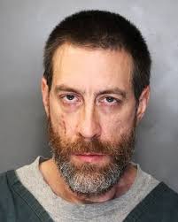 Syracuse man stabbed, struck with metal bat during burglary wants city to  listen