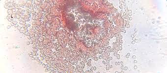 Erythrocytes, or red blood cells, are by far the predominant cell type in the blood smear. Under The Microscope Blood Office For Science And Society Mcgill University