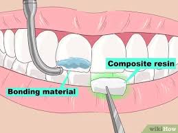 Specially formulated with baking soda to give you a noticeably whiter, brighter smile. 3 Ways To Remove Brown Stains From Teeth Wikihow