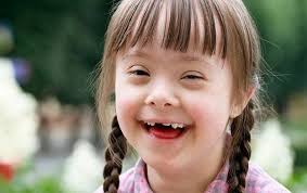 Hoy es el Día Internacional de las Personas con Síndrome de Down y desde  aquí queremos rendirle nuestro pequeño homenaje. Las queremos. Un artículo  del doctor Juan José Granizo