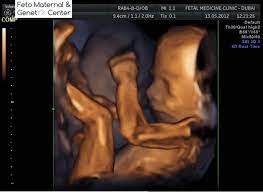 Pin On Ultrasound Scan