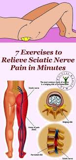 Pin On Pain In The Back