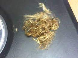 If on skin (or hair): Hair Today Gone Tomorrow Shelley S Spoutings