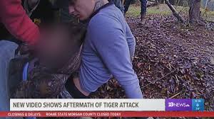 Hi team, did you change anything in attack of the base in last update please? New Video Shows Aftermath Of Tiger Attack That Nearly Ripped Off 18 Year Old S Arm Wbir Com
