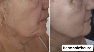 Institut Beauté Minceur Harmonie'Heure Cornebarrieu