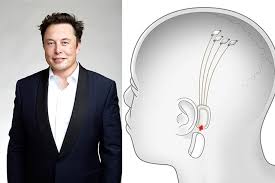 Elon Musk is developing a brain chip to stream music inside your head - Mixmag.net