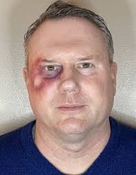 Butterface FX, Round Lake, IL 60073, US