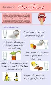 41 Home Remedies For Oral Thrush Natural Headache Remedies Oral Thrush Remedies Home Remedies For Thrush