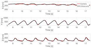 Ic1:a is selfbiasing via c2 & r5. Sensors Free Full Text A Doppler Tolerant Ultrasonic Multiple Access Localization System For Human Gait Analysis Html