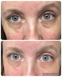 Caved in and used my points , so excited to try these 2 things ! Been  eyeballing the mermaid multi for a minute 👀i usually use sugar bear for my  sleep aid