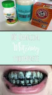 Pin On Teeth Whitening Remedies
