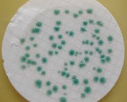 We did not find results for: Cp Chromoselect Agar Suitable For Microbiology Nutriselect Basic