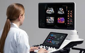 V6 Sistema de Ecografia