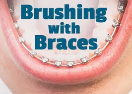 Check spelling or type a new query. Brushing With Braces In Brooklyn Drs Lee Yoon And Lorenzo
